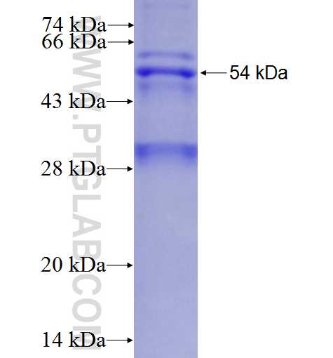 AP4M1 fusion protein Ag2222 SDS-PAGE
