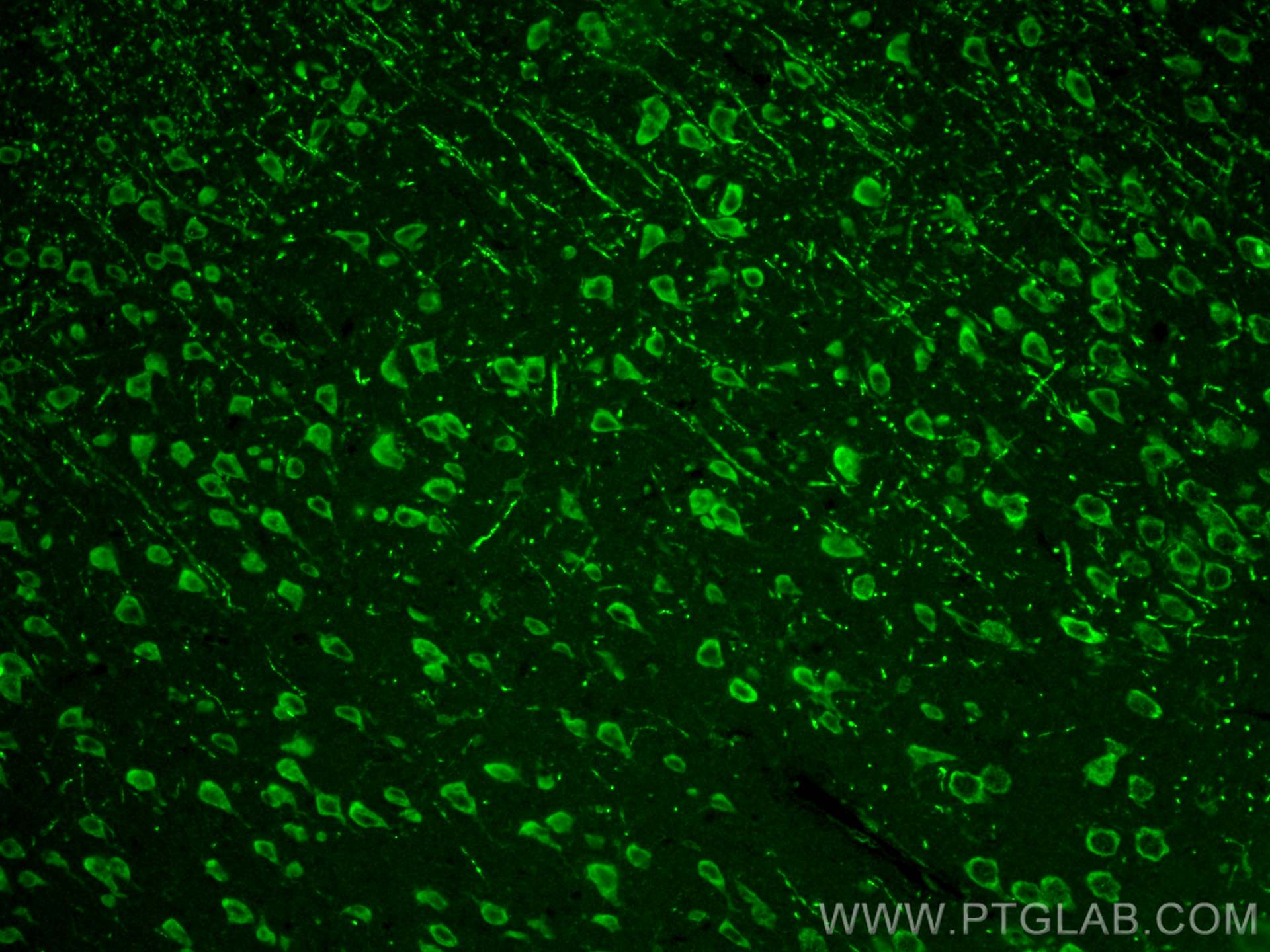 Immunofluorescence (IF) / fluorescent staining of mouse brain tissue using AP4S1 Polyclonal antibody (27202-1-AP)