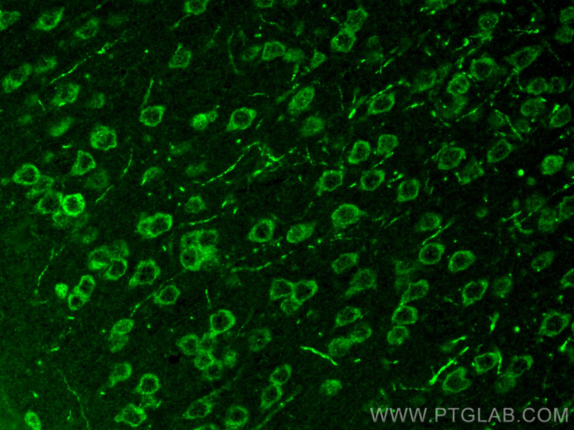 Immunofluorescence (IF) / fluorescent staining of mouse brain tissue using AP4S1 Polyclonal antibody (27202-1-AP)