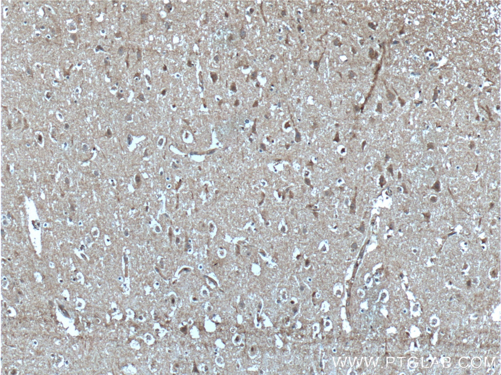 Immunohistochemistry (IHC) staining of human brain tissue using AP4S1 Polyclonal antibody (27202-1-AP)