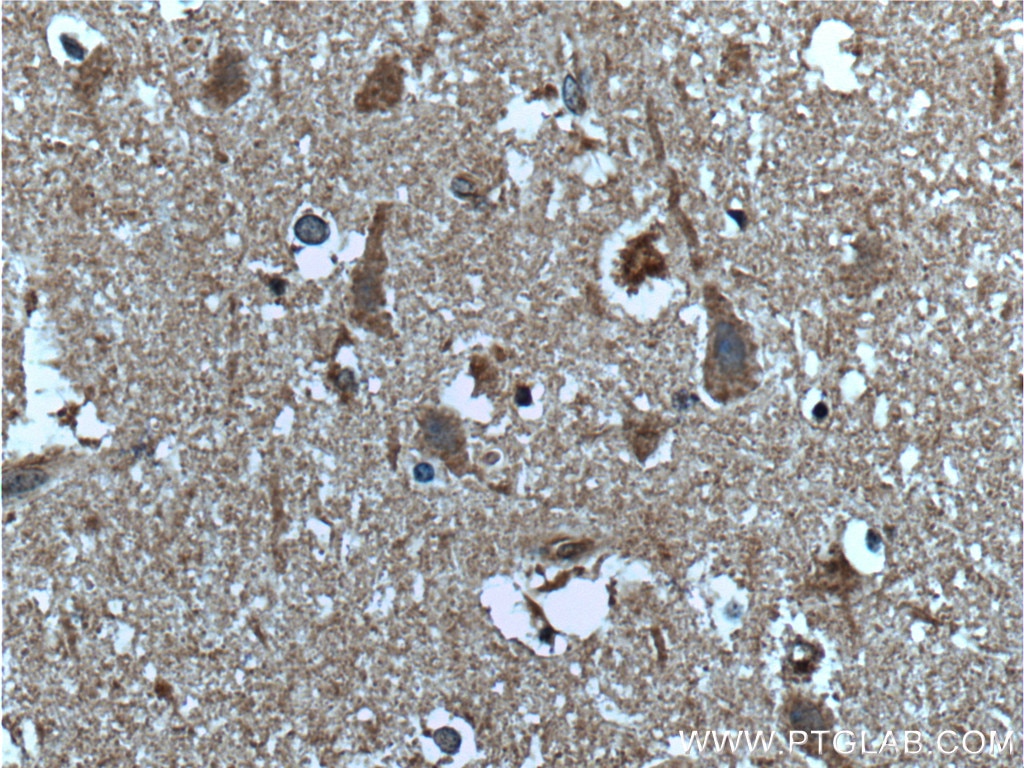 IHC staining of human brain using 27202-1-AP