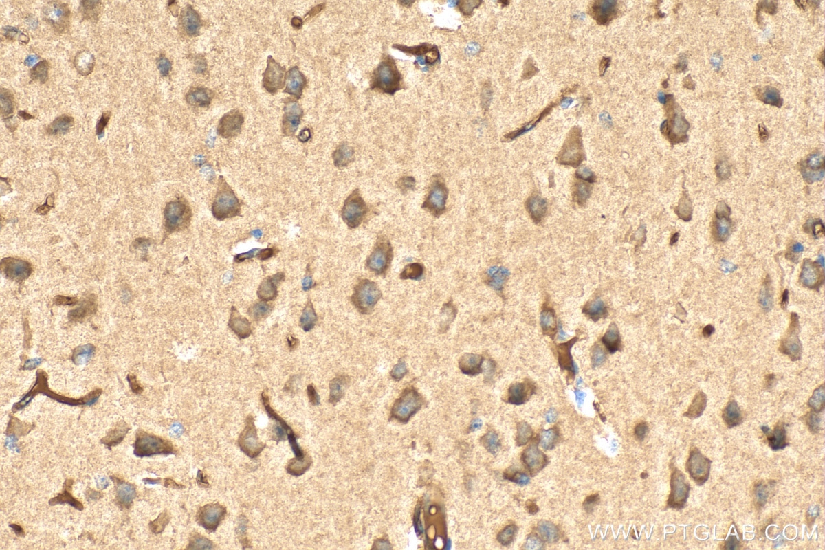 IHC staining of mouse brain using 27202-1-AP