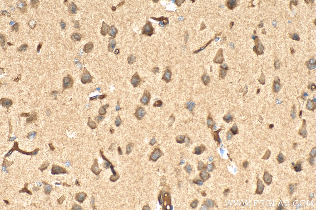 Immunohistochemistry (IHC) staining of mouse brain tissue using AP4S1 Polyclonal antibody (27202-1-AP)