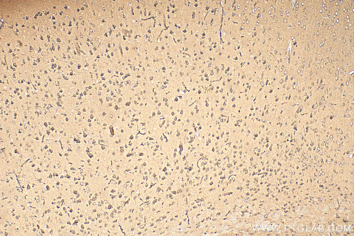 Immunohistochemistry (IHC) staining of mouse brain tissue using AP4S1 Polyclonal antibody (27202-1-AP)