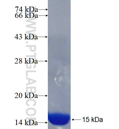 AP4S1 fusion protein Ag25661 SDS-PAGE