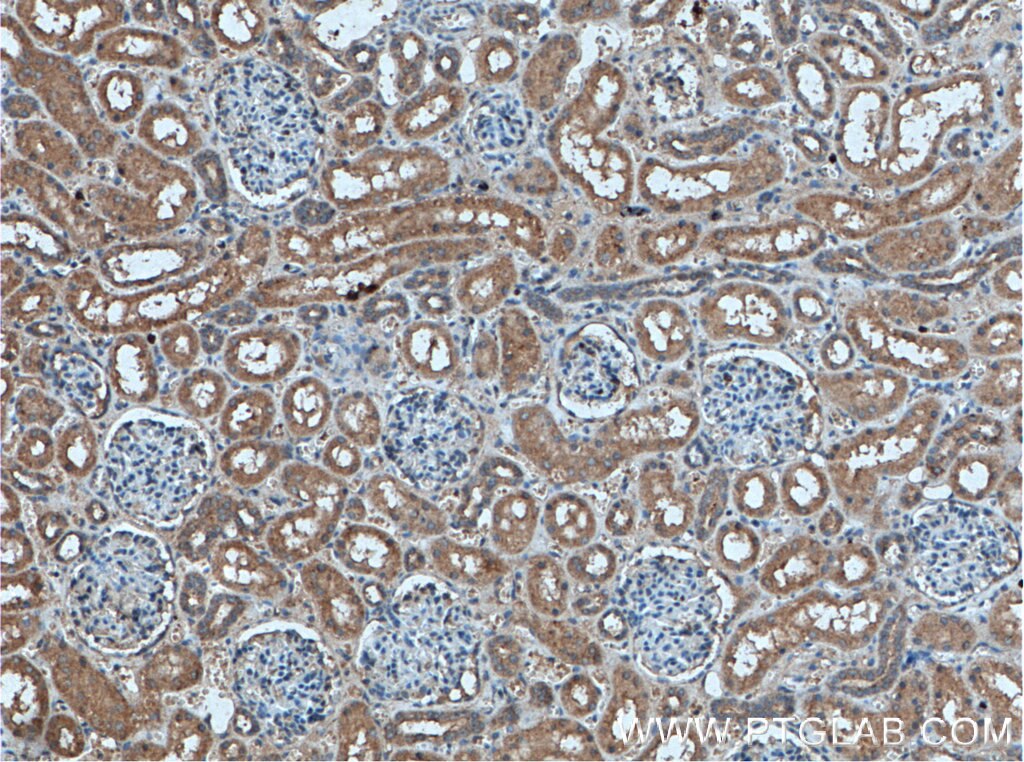 Immunohistochemistry (IHC) staining of human kidney tissue using AP50 Polyclonal antibody (27355-1-AP)