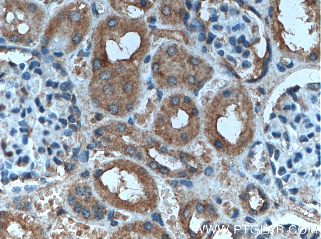 Immunohistochemistry (IHC) staining of human kidney tissue using AP50 Polyclonal antibody (27355-1-AP)