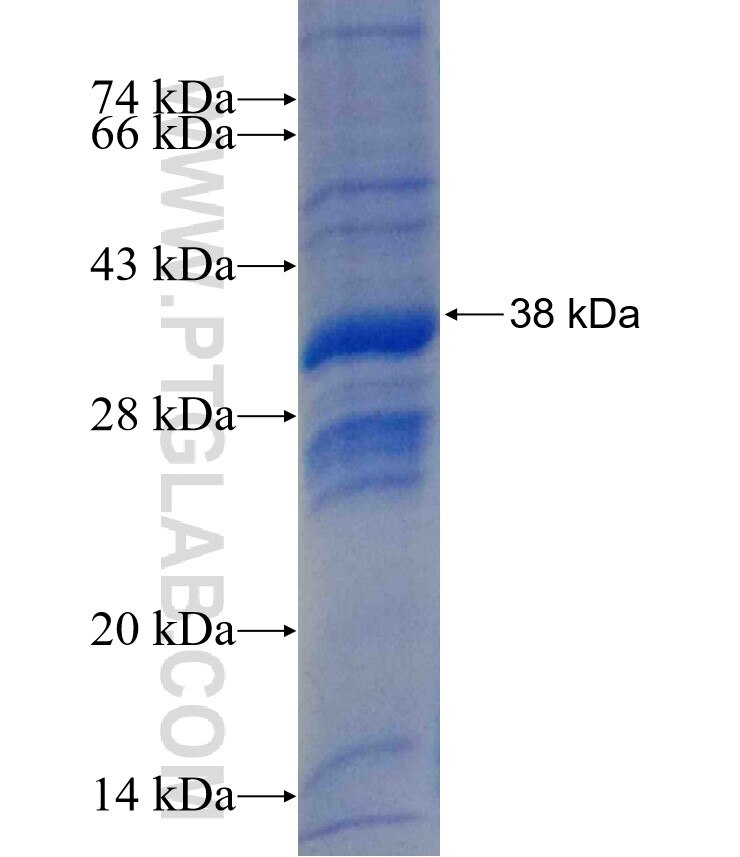 AP50 fusion protein Ag26059 SDS-PAGE