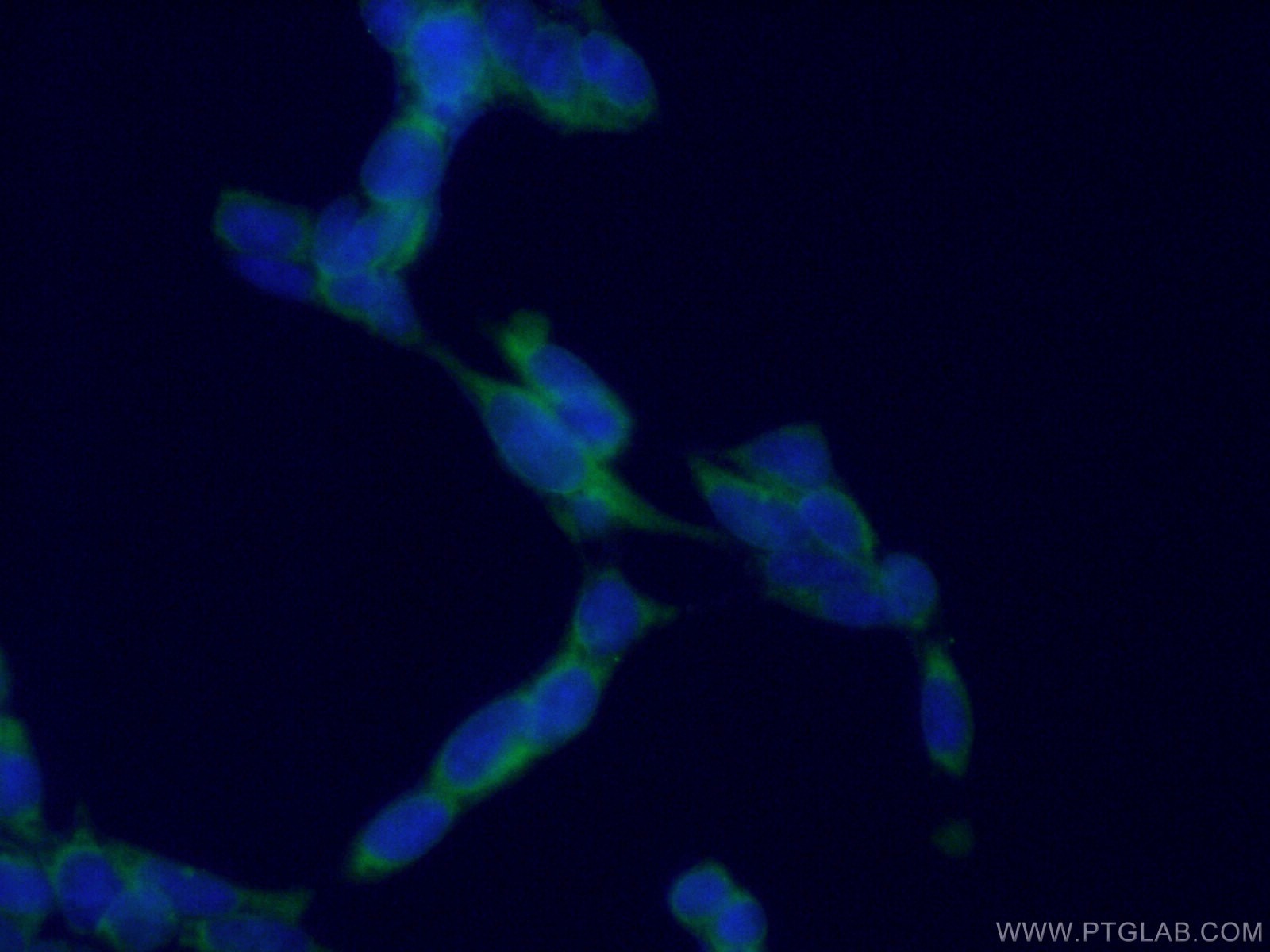 Immunofluorescence (IF) / fluorescent staining of HEK-293 cells using AP5Z1/SPG48 Monoclonal antibody (66533-1-Ig)