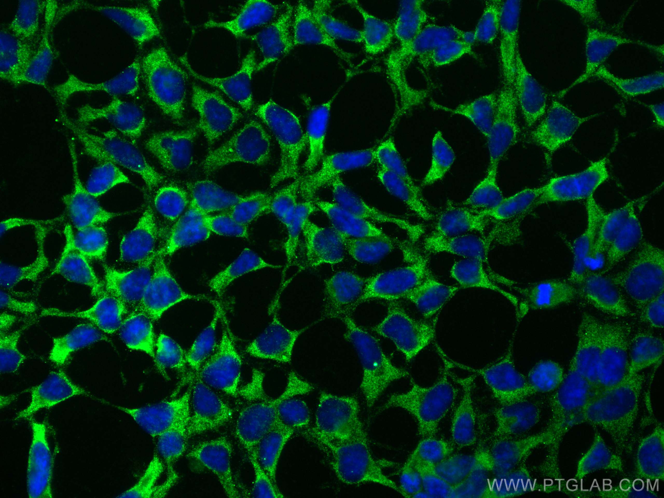Immunofluorescence (IF) / fluorescent staining of HEK-293 cells using AP5Z1/SPG48 Monoclonal antibody (66533-1-Ig)