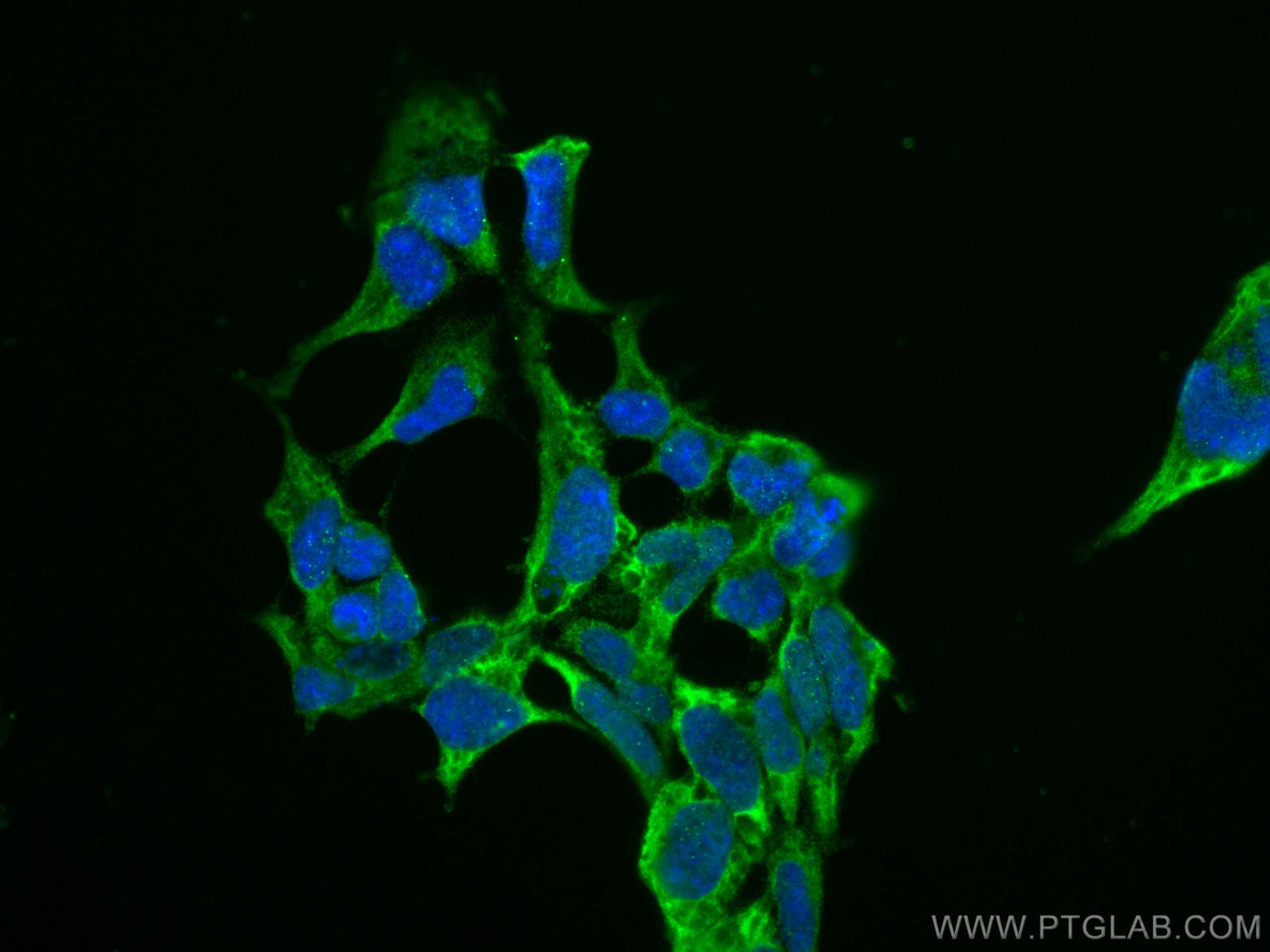 Immunofluorescence (IF) / fluorescent staining of HEK-293 cells using CoraLite® Plus 488-conjugated AP5Z1/SPG48 Monoclon (CL488-66533)