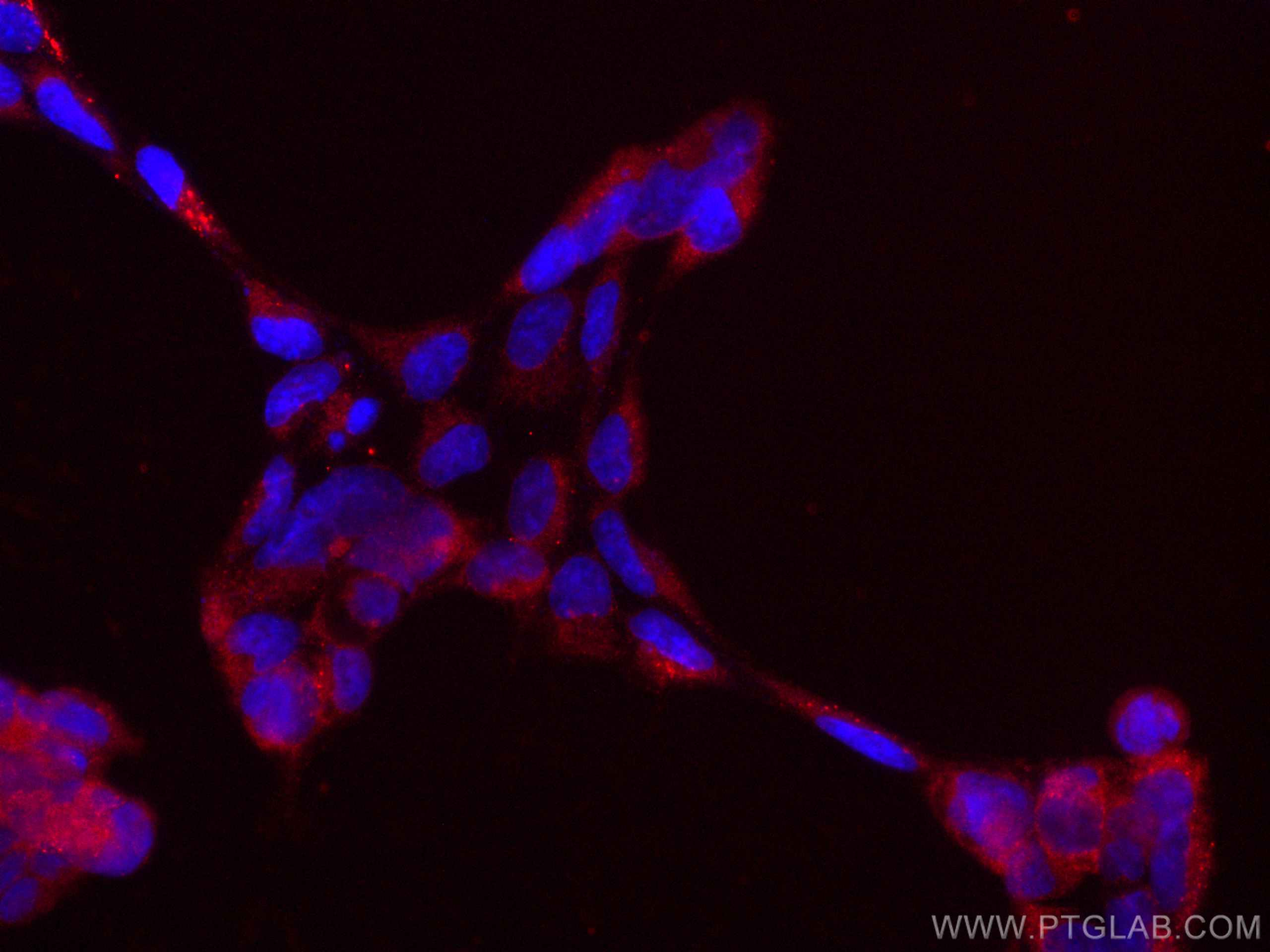 Immunofluorescence (IF) / fluorescent staining of HEK-293 cells using CoraLite®594-conjugated AP5Z1/SPG48 Monoclonal ant (CL594-66533)