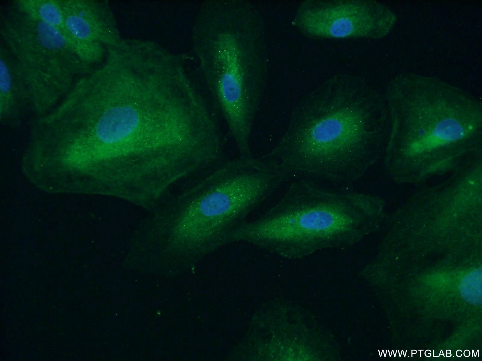 Immunofluorescence (IF) / fluorescent staining of A549 cells using APAF1 Polyclonal antibody (21710-1-AP)