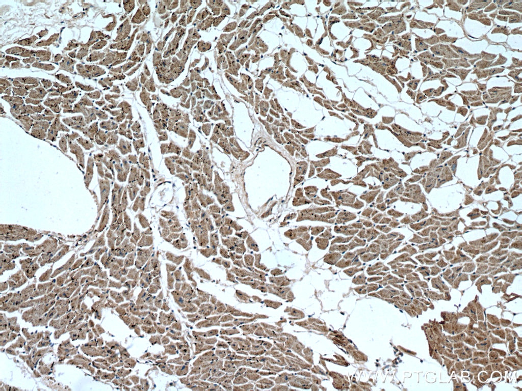 Immunohistochemistry (IHC) staining of human heart tissue using APAF1 Polyclonal antibody (21710-1-AP)