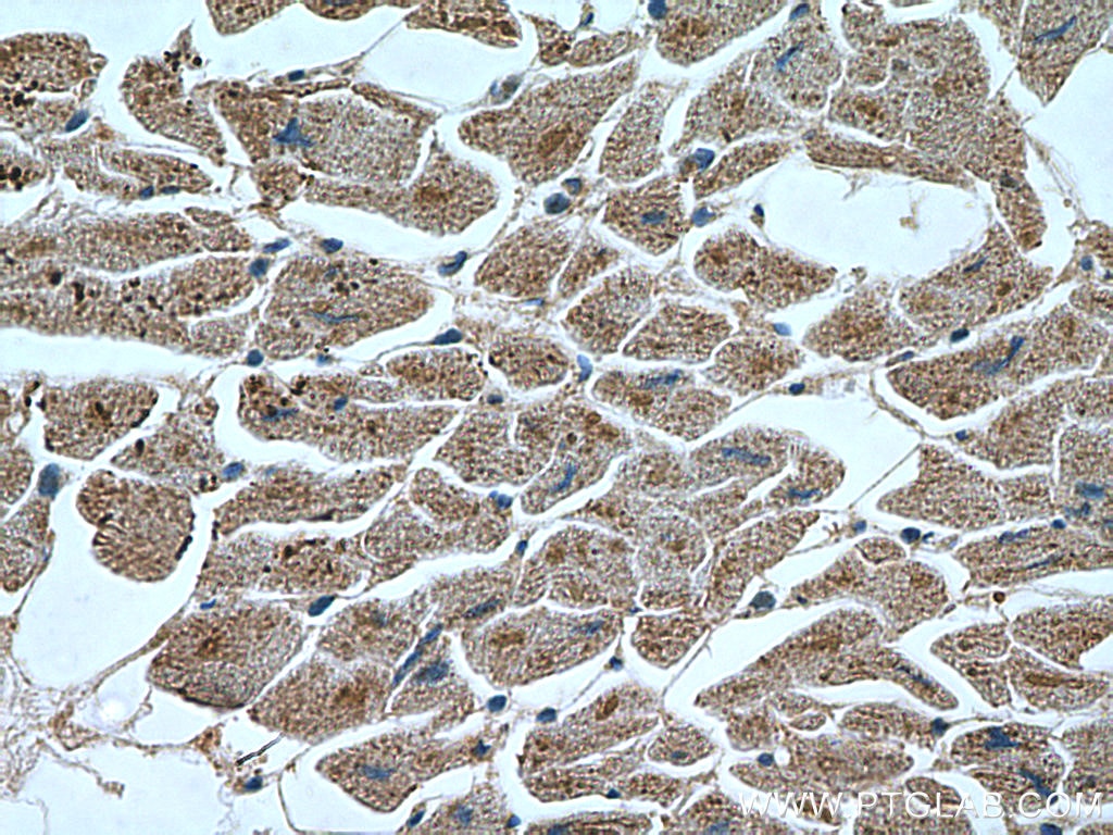 Immunohistochemistry (IHC) staining of human heart tissue using APAF1 Polyclonal antibody (21710-1-AP)