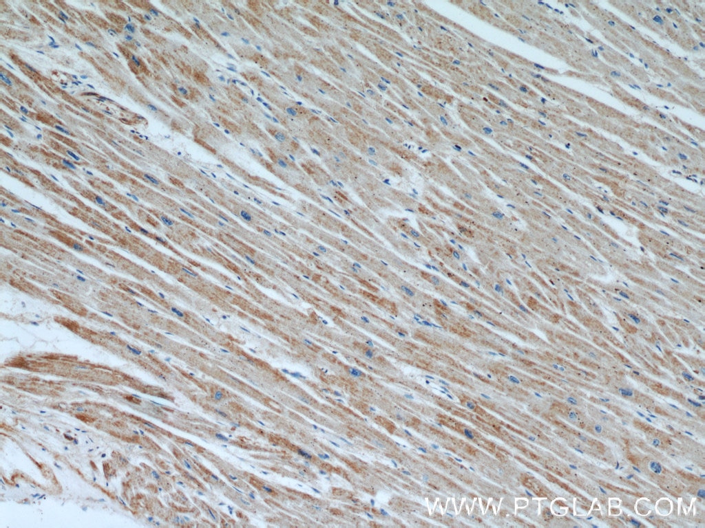 Immunohistochemistry (IHC) staining of human heart tissue using APAF1 Polyclonal antibody (21710-1-AP)