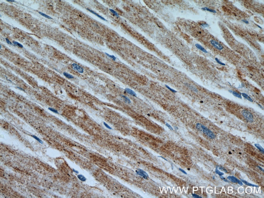 Immunohistochemistry (IHC) staining of human heart tissue using APAF1 Polyclonal antibody (21710-1-AP)