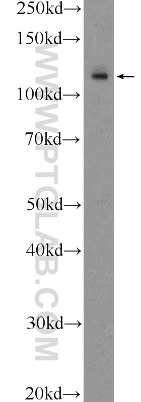 Western Blot (WB) analysis of A549 cells using APAF1 Polyclonal antibody (21710-1-AP)