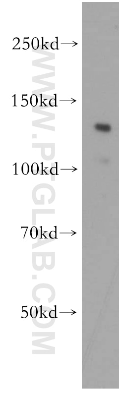 Western Blot (WB) analysis of HEK-293 cells using APAF1 Polyclonal antibody (21710-1-AP)