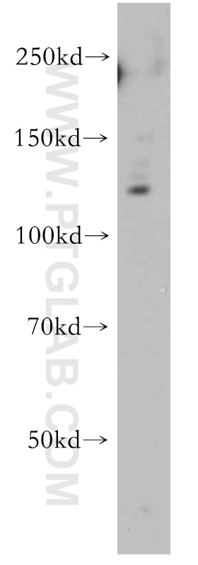 Western Blot (WB) analysis of COLO 320 cells using APAF1 Polyclonal antibody (21710-1-AP)