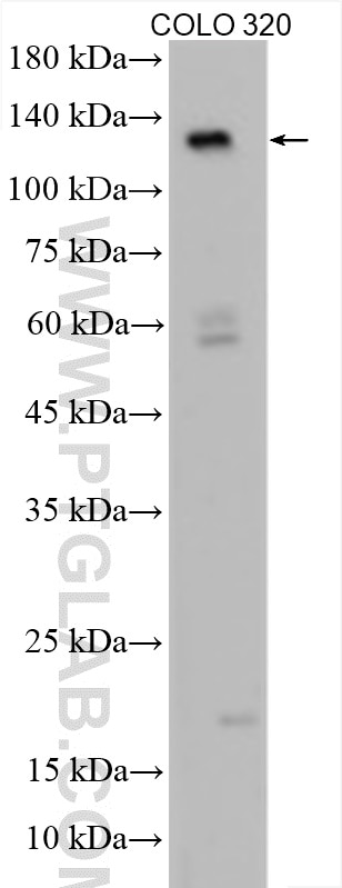 Western Blot (WB) analysis of COLO 320 cells using APAF1 Polyclonal antibody (29022-1-AP)