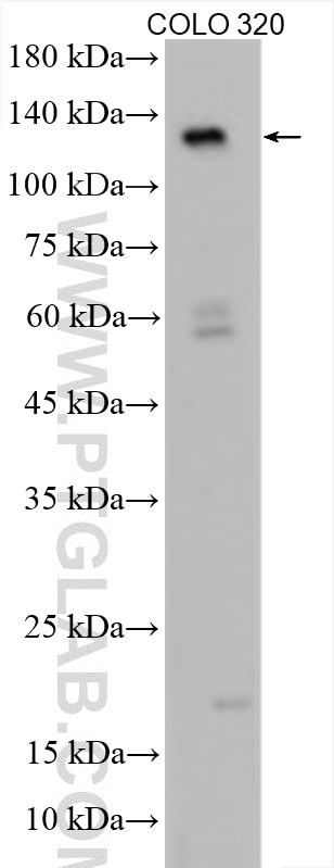 WB analysis of COLO 320 using 29022-1-AP