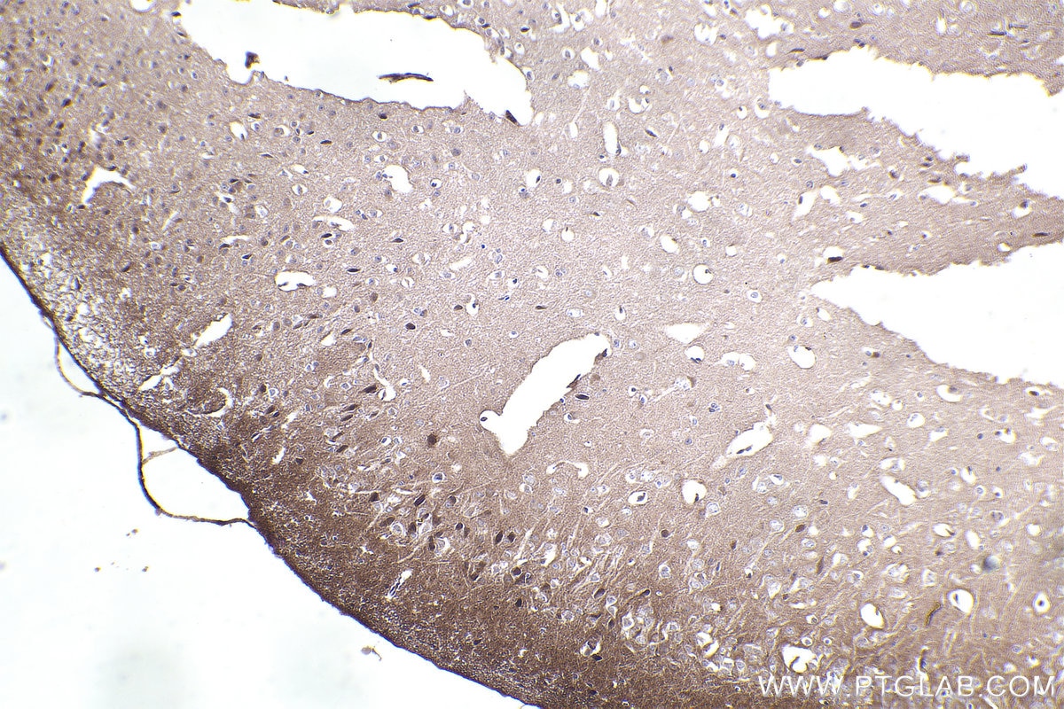 Immunohistochemistry (IHC) staining of mouse brain tissue using APBA1 Polyclonal antibody (55089-1-AP)