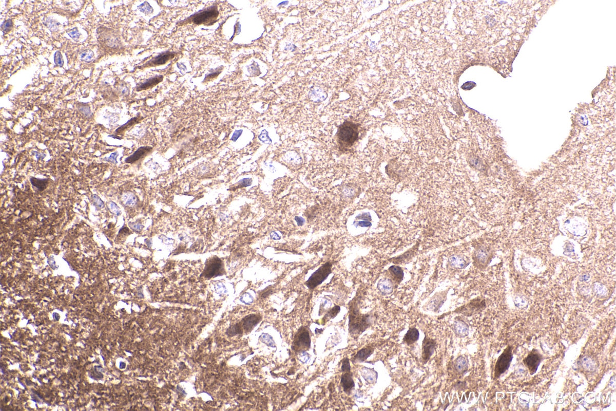 Immunohistochemistry (IHC) staining of mouse brain tissue using APBA1 Polyclonal antibody (55089-1-AP)