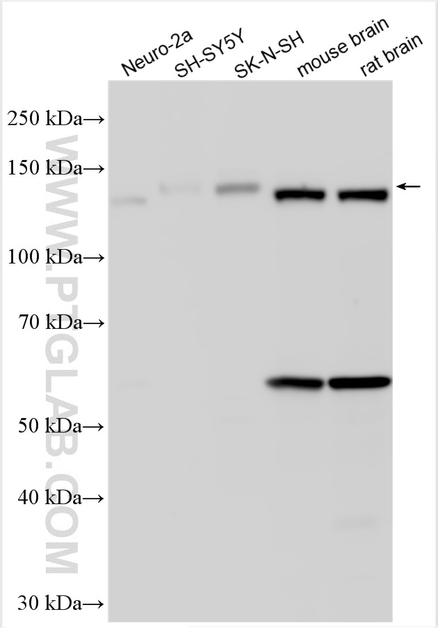 Western Blot (WB) analysis of various lysates using APBA1 Polyclonal antibody (55089-1-AP)