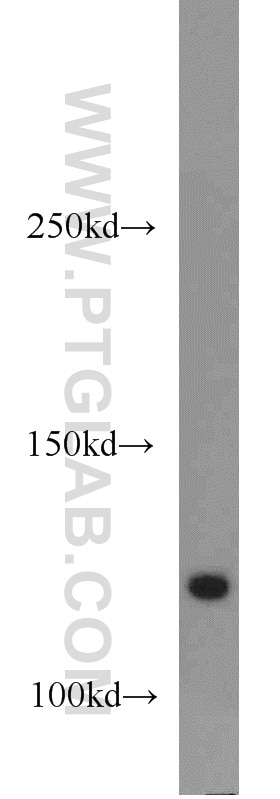 Western Blot (WB) analysis of mouse brain tissue using APBA2 Polyclonal antibody (19781-1-AP)