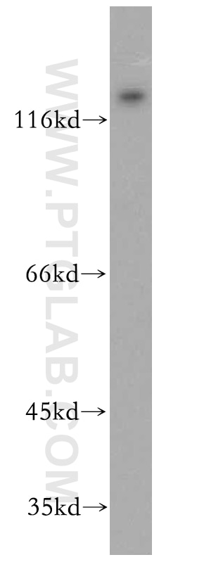 Western Blot (WB) analysis of mouse brain tissue using APBA2 Polyclonal antibody (19781-1-AP)