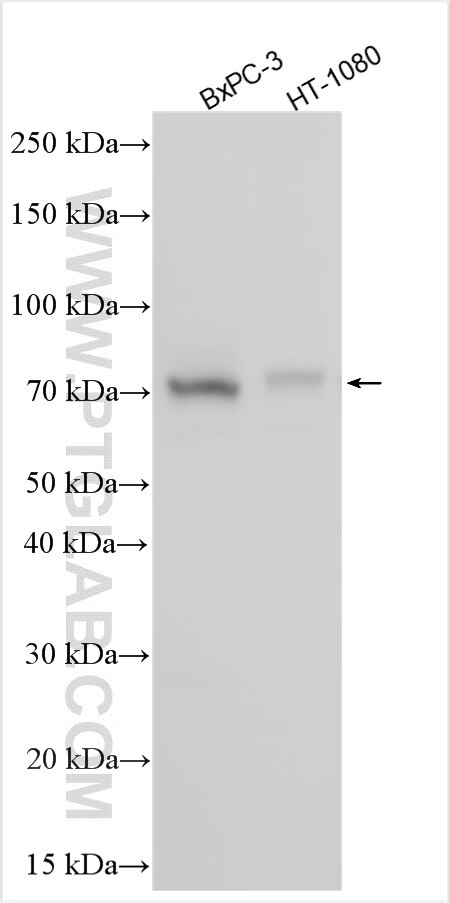 Western Blot (WB) analysis of various lysates using APBA3 Polyclonal antibody (20812-1-AP)