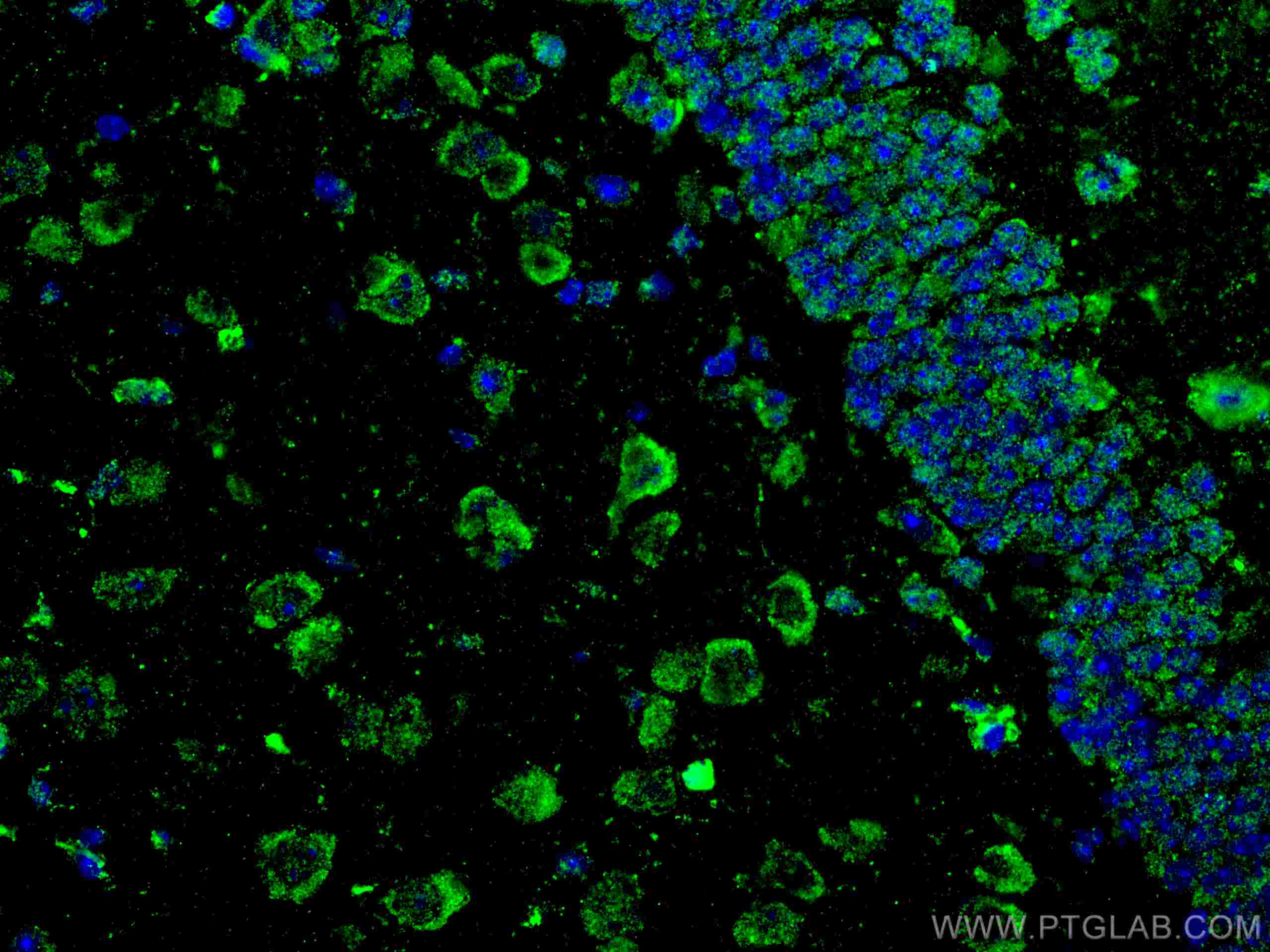 Immunofluorescence (IF) / fluorescent staining of mouse brain tissue using APBB1 Monoclonal antibody (67077-1-Ig)