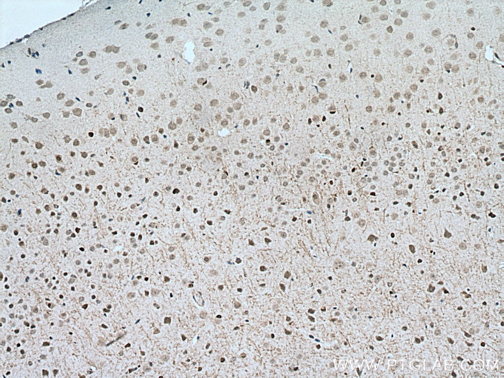 Immunohistochemistry (IHC) staining of mouse brain tissue using APBB1 Monoclonal antibody (67077-1-Ig)