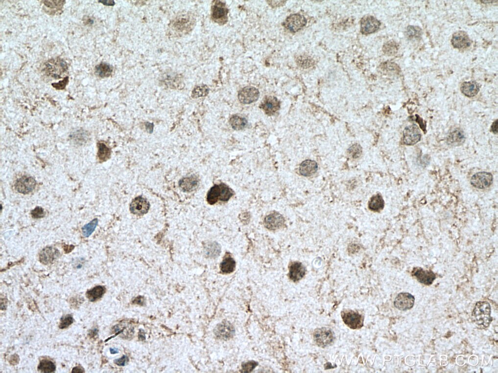 Immunohistochemistry (IHC) staining of mouse brain tissue using APBB1 Monoclonal antibody (67077-1-Ig)