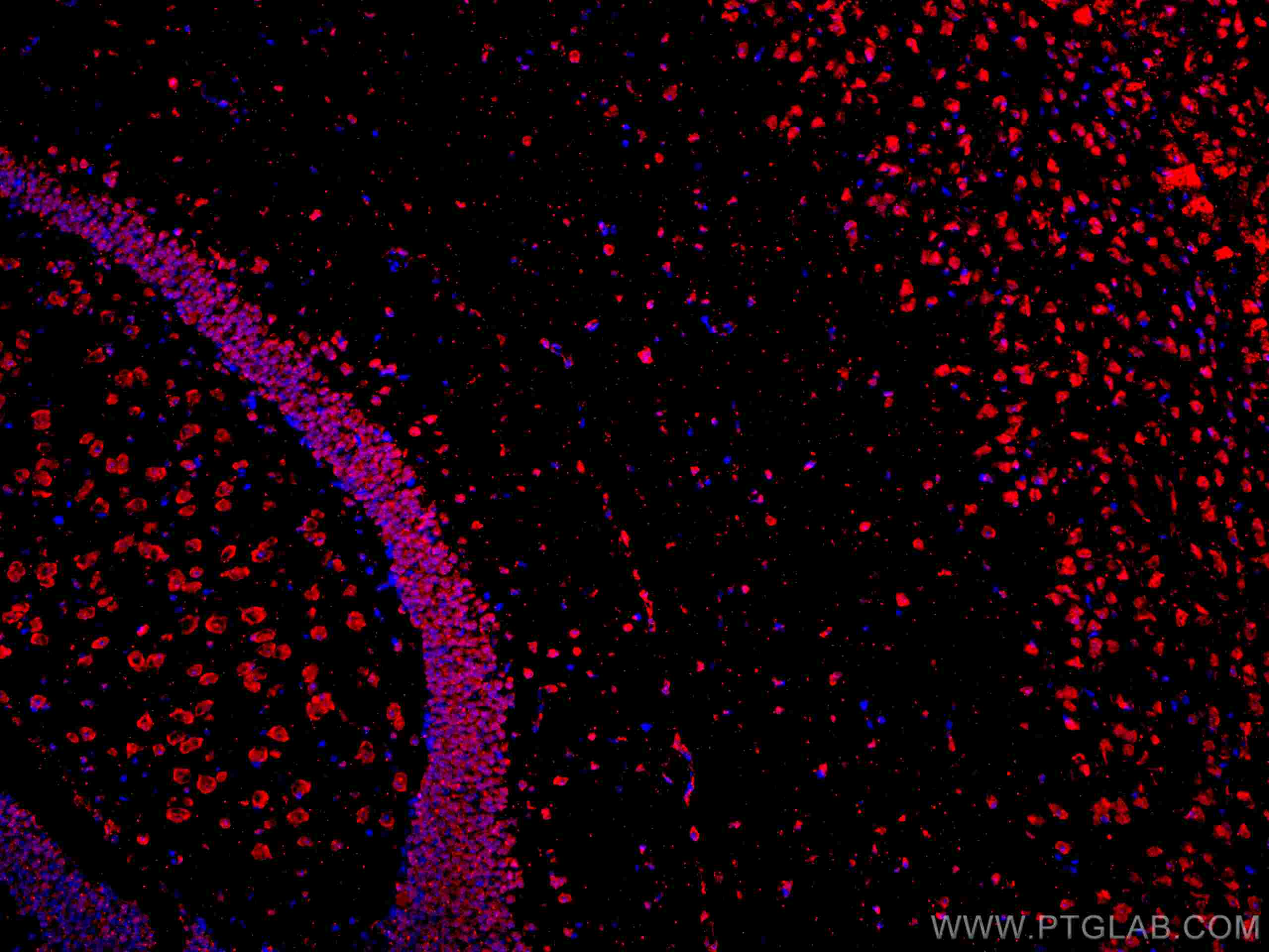 Immunofluorescence (IF) / fluorescent staining of mouse brain tissue using CoraLite®594-conjugated APBB1 Monoclonal antibody (CL594-67077)