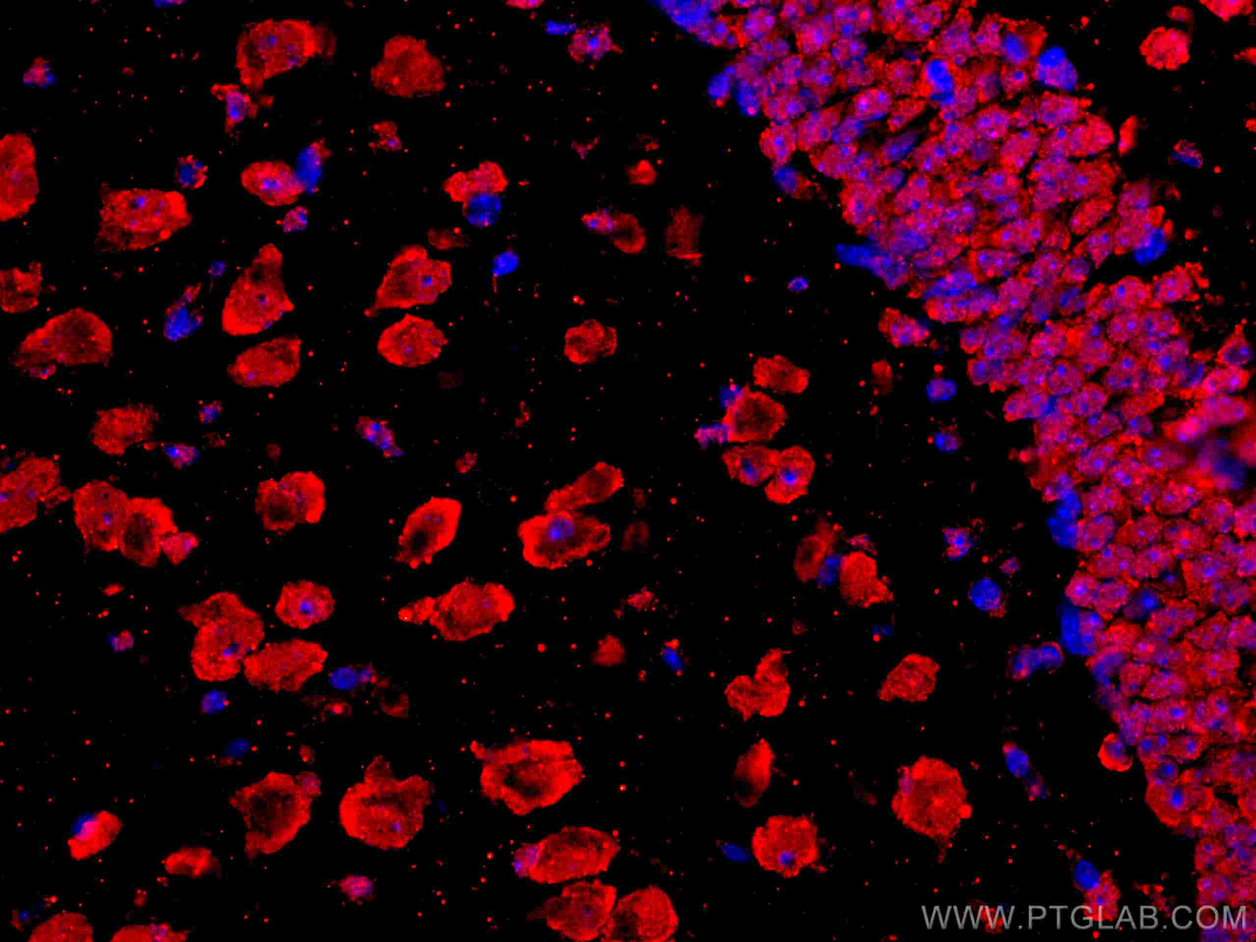 Immunofluorescence (IF) / fluorescent staining of mouse brain tissue using CoraLite®594-conjugated APBB1 Monoclonal antibody (CL594-67077)