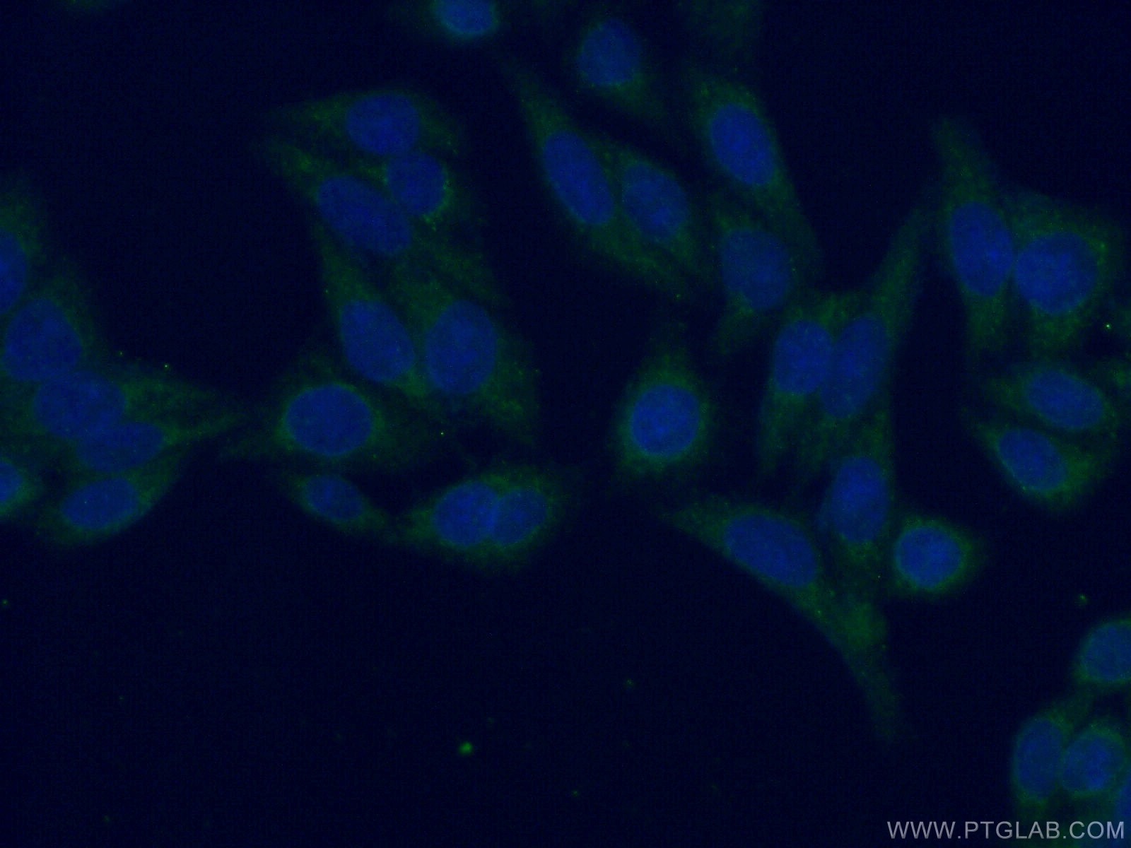 Immunofluorescence (IF) / fluorescent staining of HeLa cells using APBB2 Polyclonal antibody (13177-1-AP)