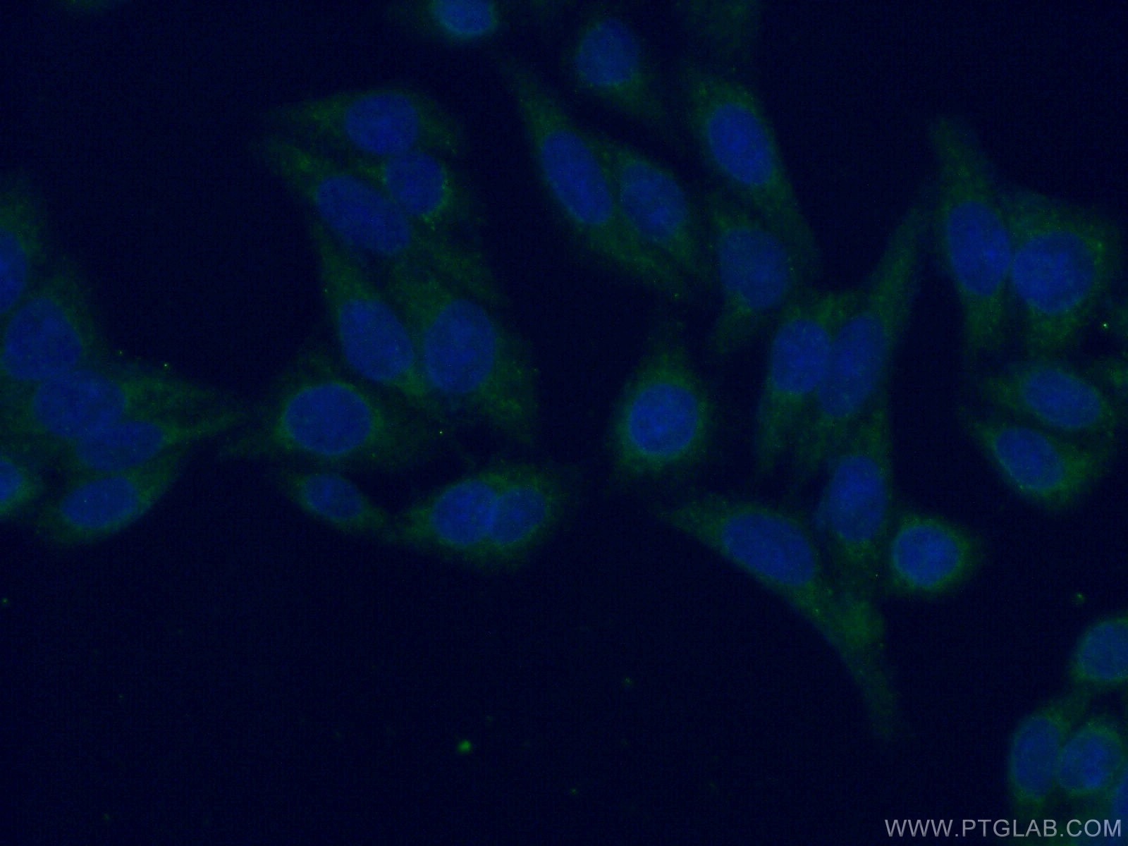 IF Staining of HeLa using 13177-1-AP