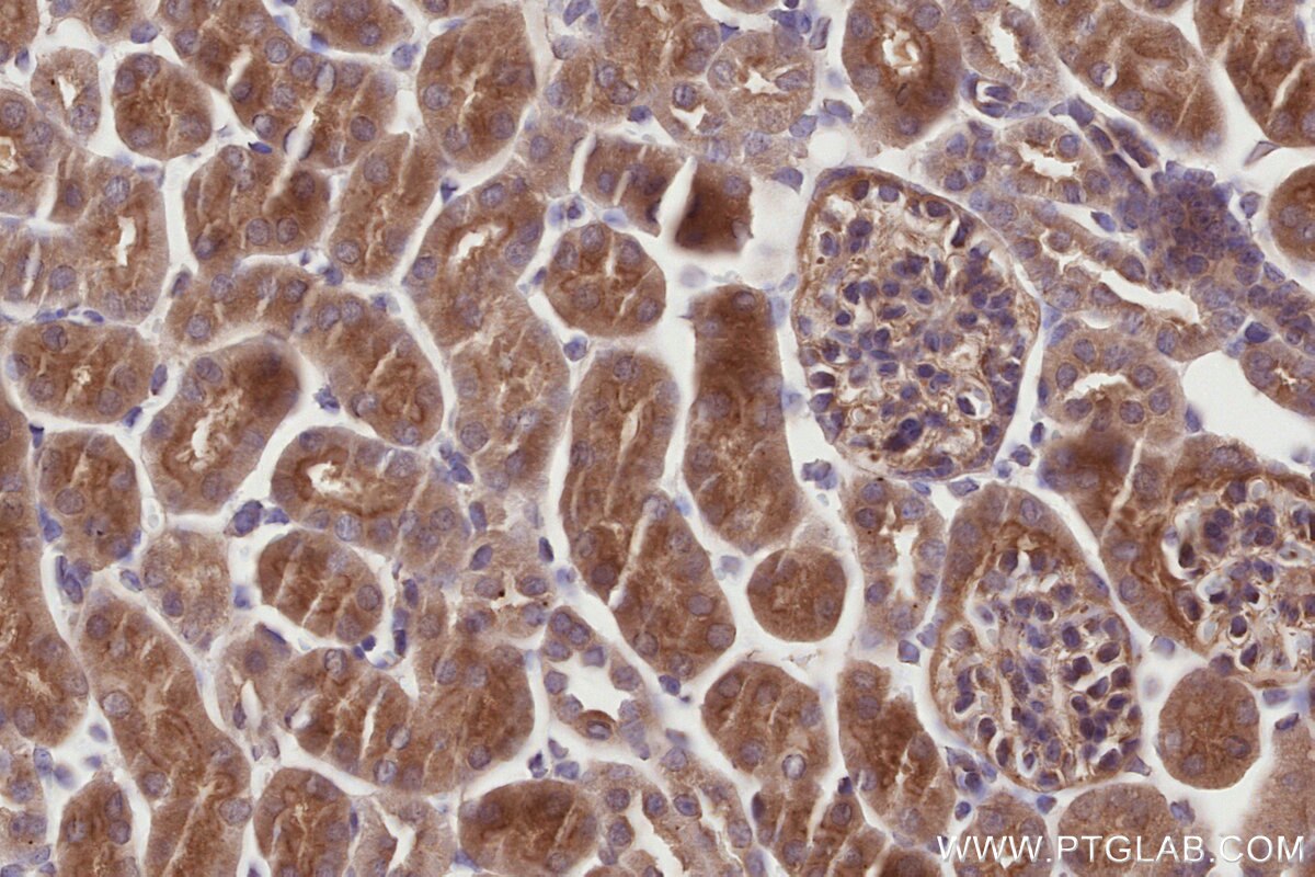 Immunohistochemistry (IHC) staining of mouse kidney tissue using APBB2 Polyclonal antibody (13177-1-AP)
