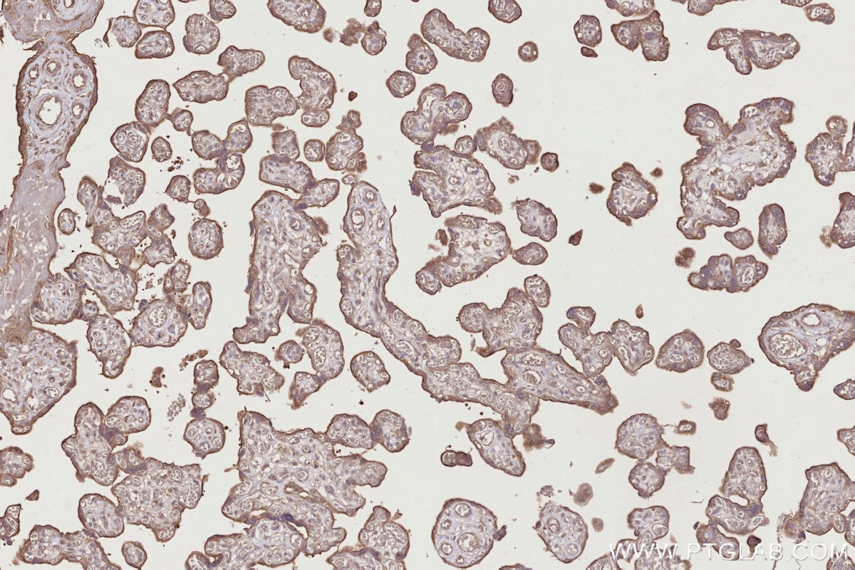 Immunohistochemistry (IHC) staining of human placenta tissue using APBB2 Polyclonal antibody (13177-1-AP)