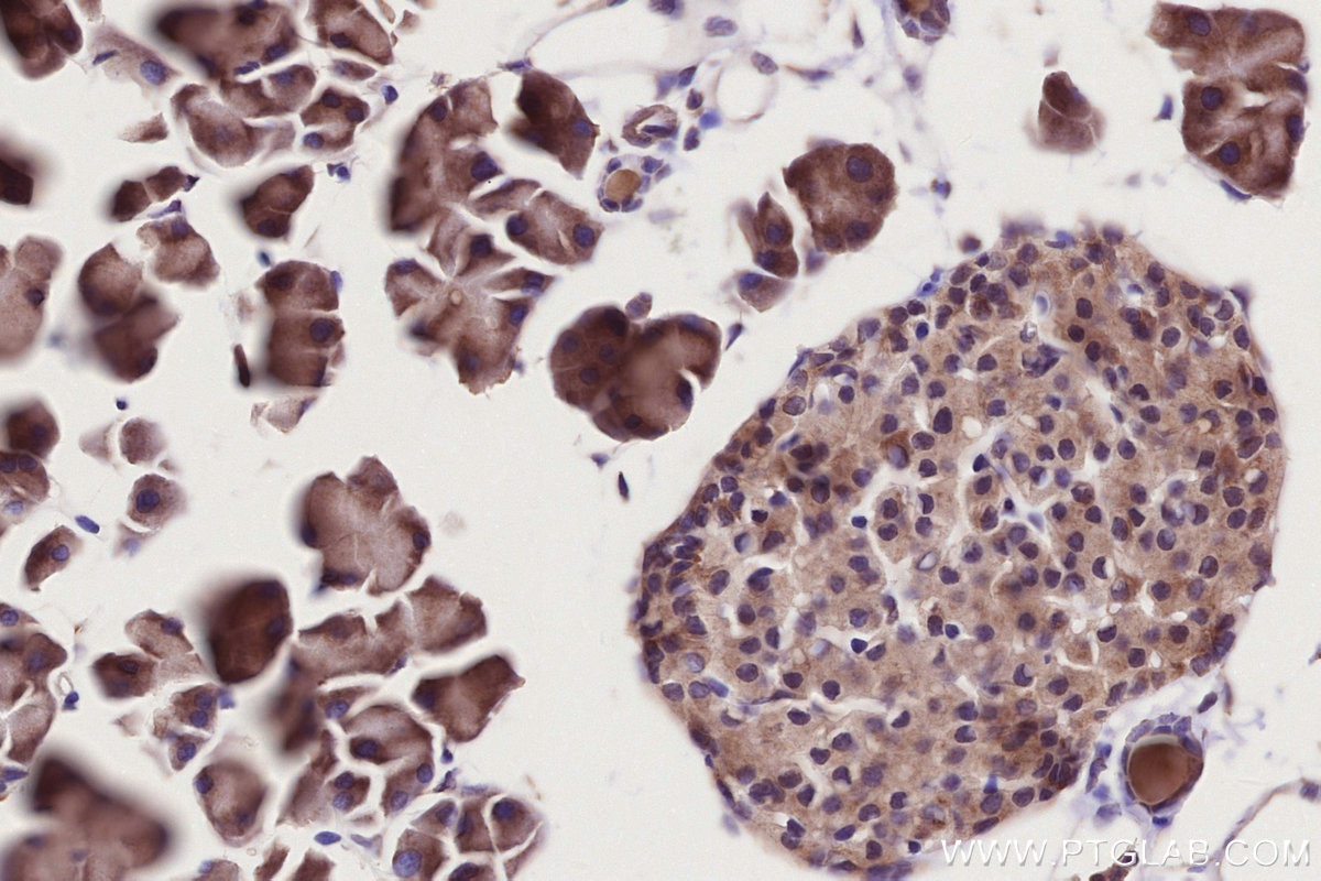 Immunohistochemistry (IHC) staining of mouse pancreas tissue using APBB2 Polyclonal antibody (13177-1-AP)