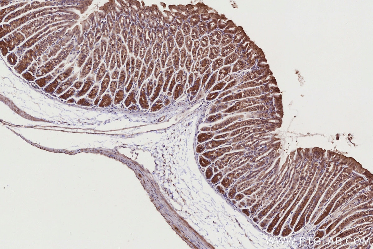 Immunohistochemistry (IHC) staining of mouse stomach tissue using APBB2 Polyclonal antibody (13177-1-AP)