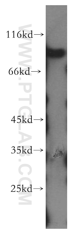 Western Blot (WB) analysis of human brain tissue using APBB2 Polyclonal antibody (13177-1-AP)