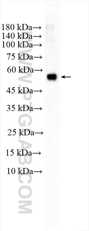 Western Blot (WB) analysis of human plasma using APBB3 Polyclonal antibody (12051-1-AP)