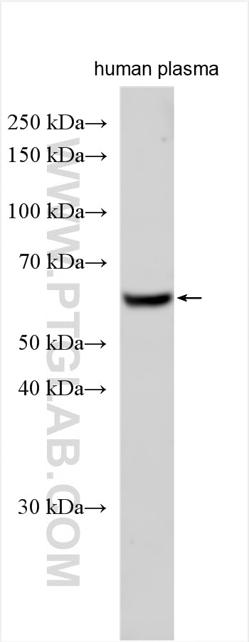 Western Blot (WB) analysis of various lysates using APBB3 Polyclonal antibody (12051-1-AP)