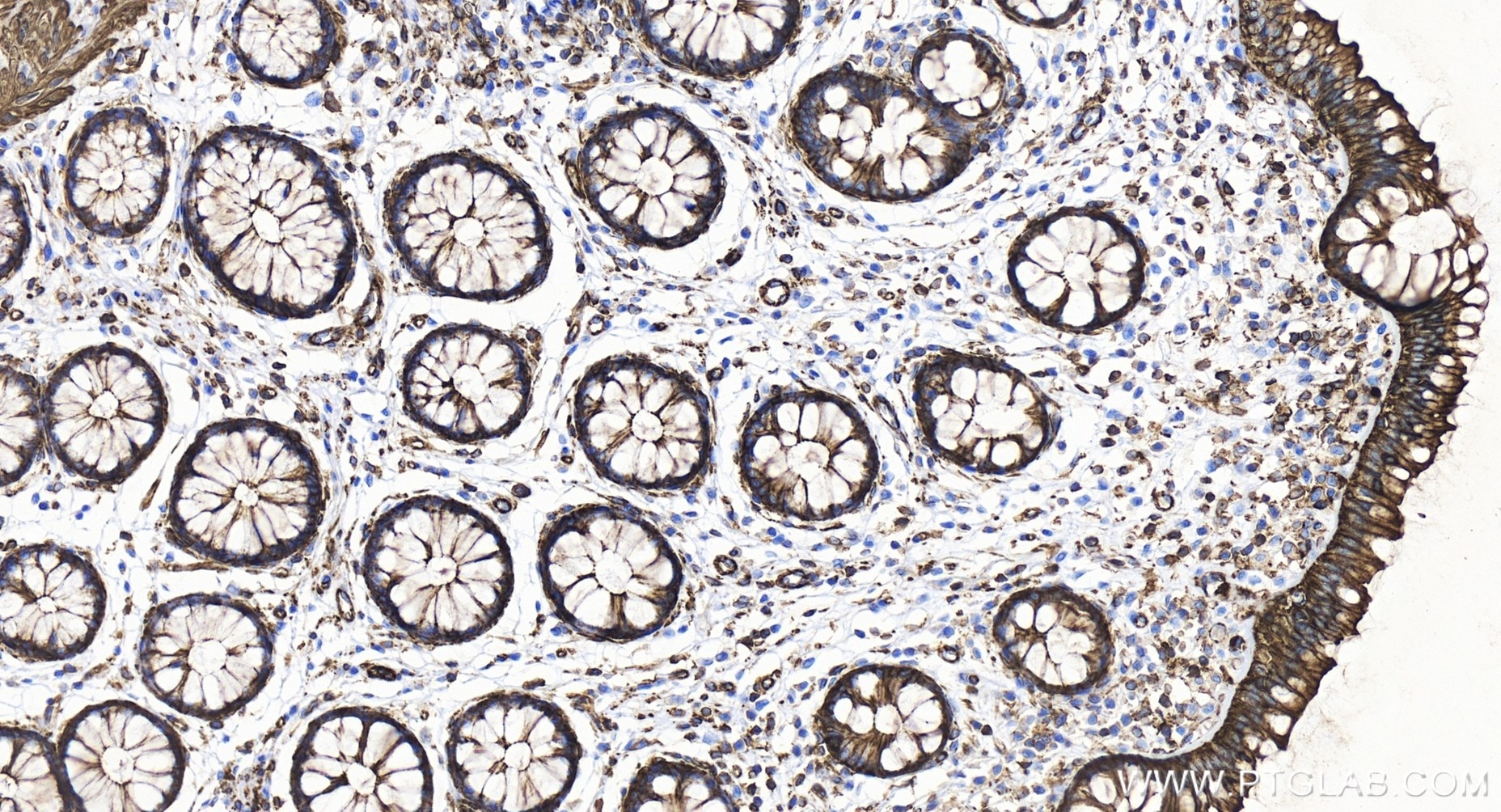 Immunohistochemistry (IHC) staining of human colon tissue using APC Recombinant antibody (85372-1-RR)