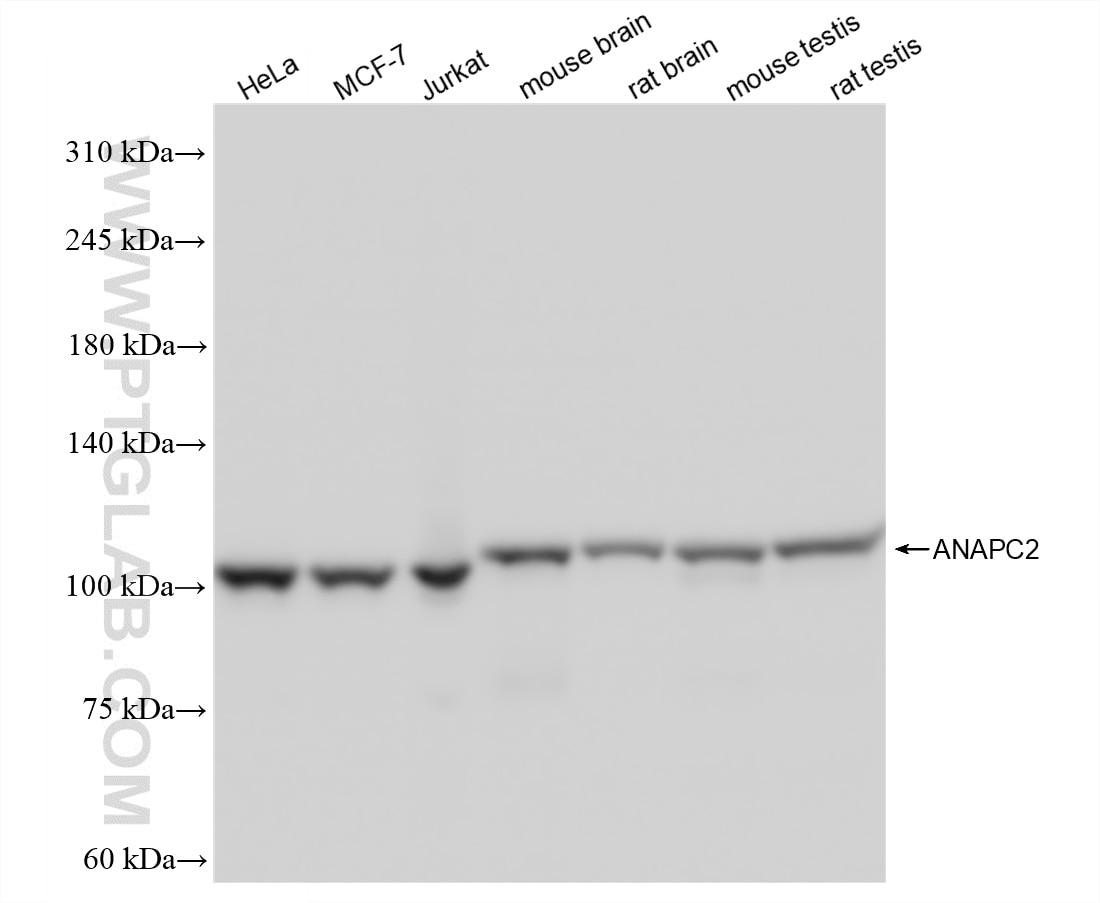 Western Blot (WB) analysis of various lysates using APC2 Recombinant monoclonal antibody (86653-1-RR)