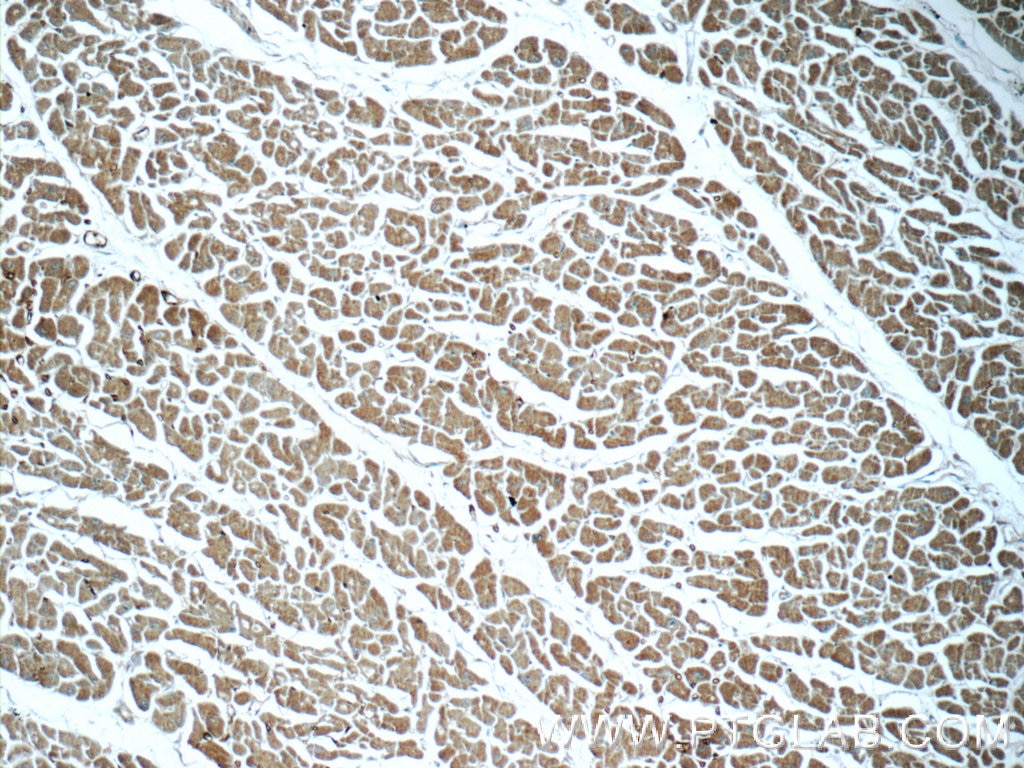 Immunohistochemistry (IHC) staining of human heart tissue using APCDD1 Polyclonal antibody (17024-1-AP)