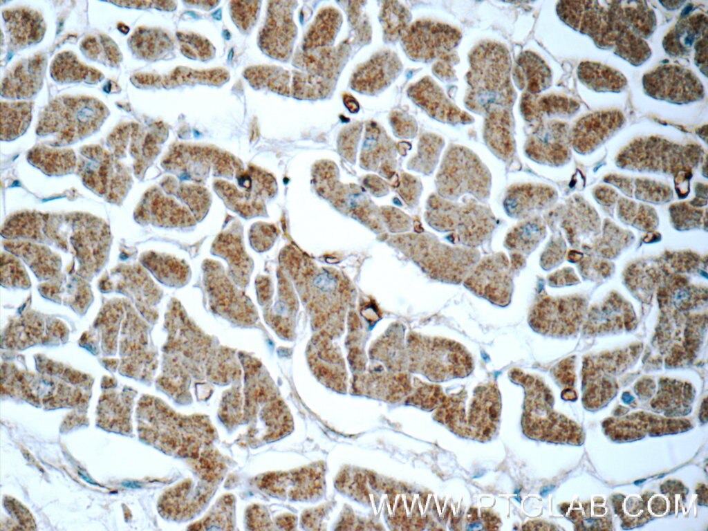 Immunohistochemistry (IHC) staining of human heart tissue using APCDD1 Polyclonal antibody (17024-1-AP)